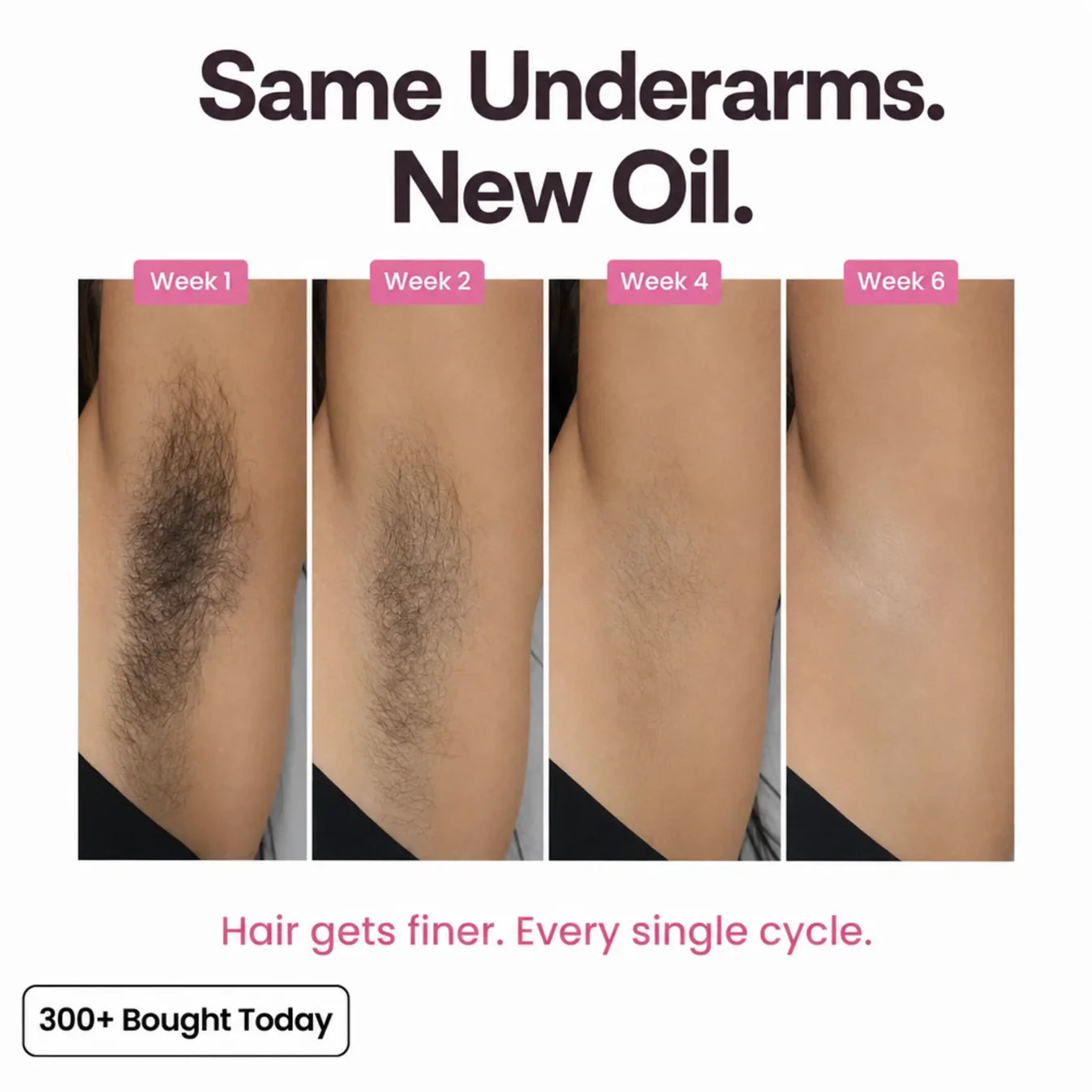 Nutrazen Cyperus Caramel Hair Removal Oil