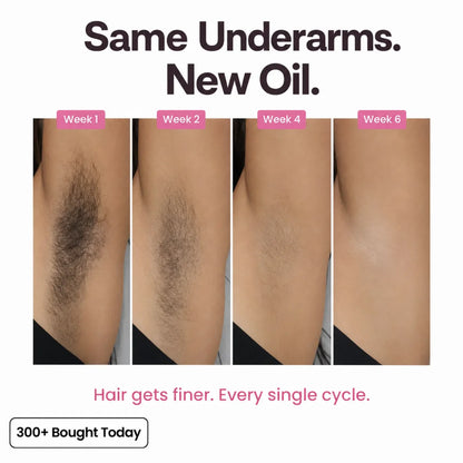 Nutrazen Cyperus Caramel Hair Removal Oil