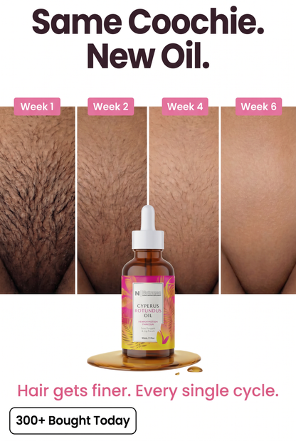 Nutrazen Cyperus Caramel Hair Removal Oil